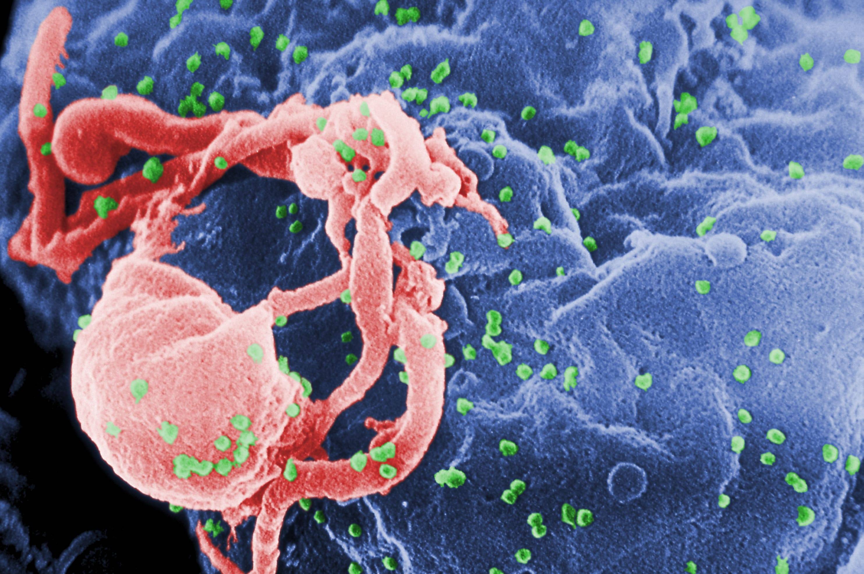 HIV, 'Istituto Pasteur scoperto metodo per distruggere virus