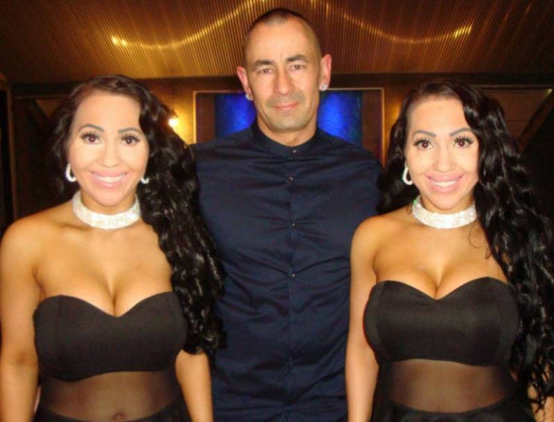 Dall'Australia la storia bizzarra di due gemelle che amano lo stesso uomo. Le due hanno speso anche una sostanziosa somma di denaro per assomigliarsi