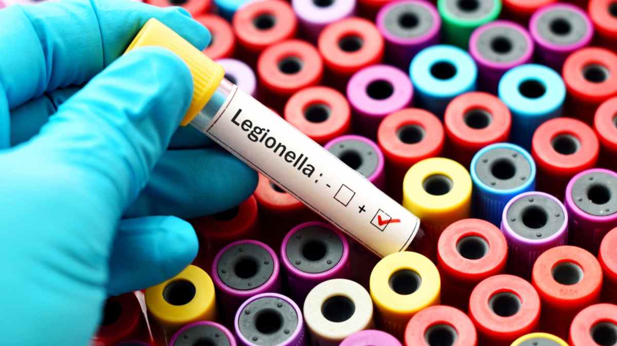 trento legionella turisti morti