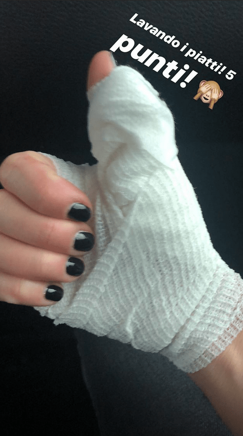 Rai 2, Detto Fatto: mano fasciata per la conduttrice Bianca Guaccero