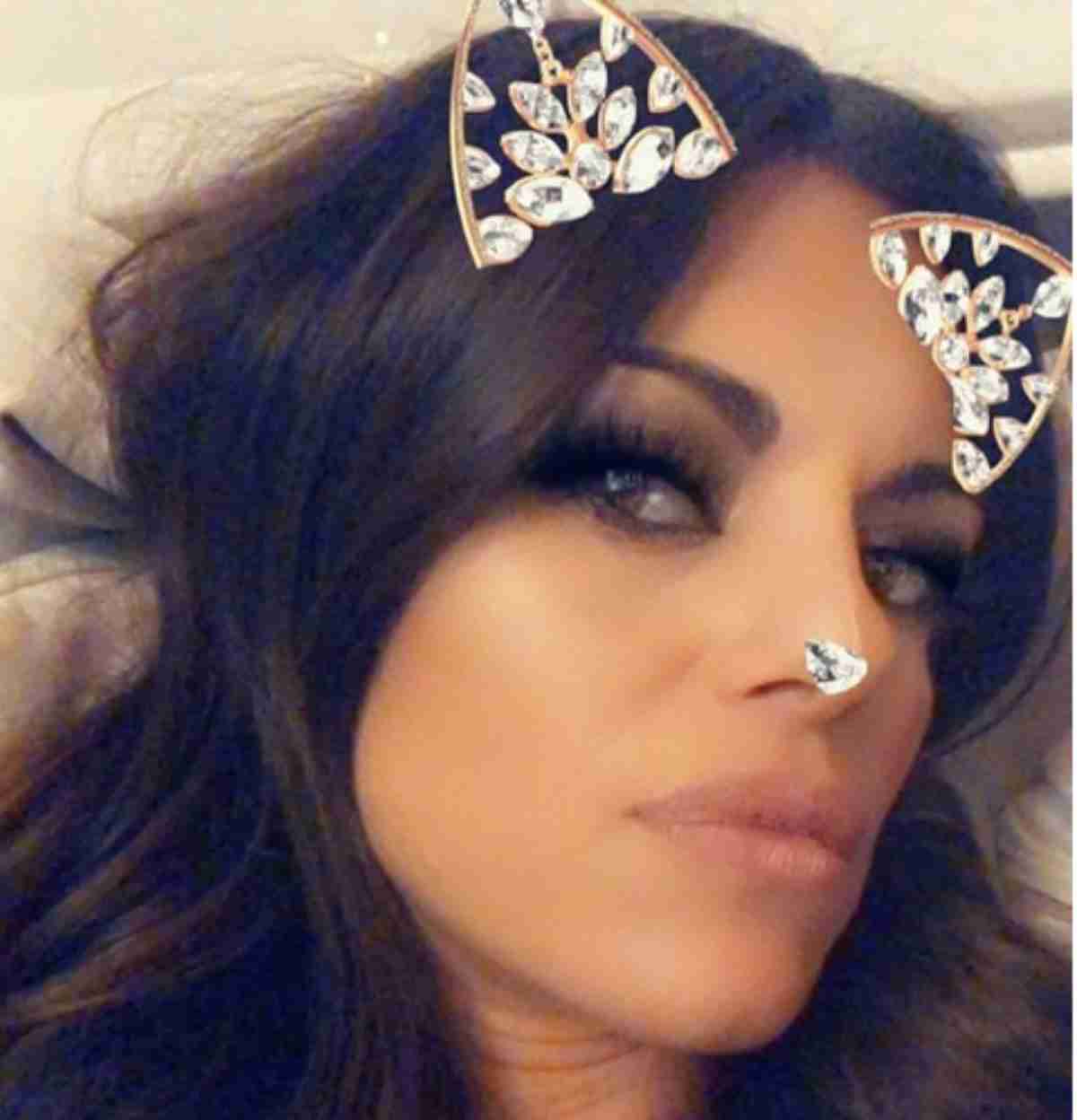 Rai 2, Detto Fatto: mano fasciata per la conduttrice Bianca Guaccero