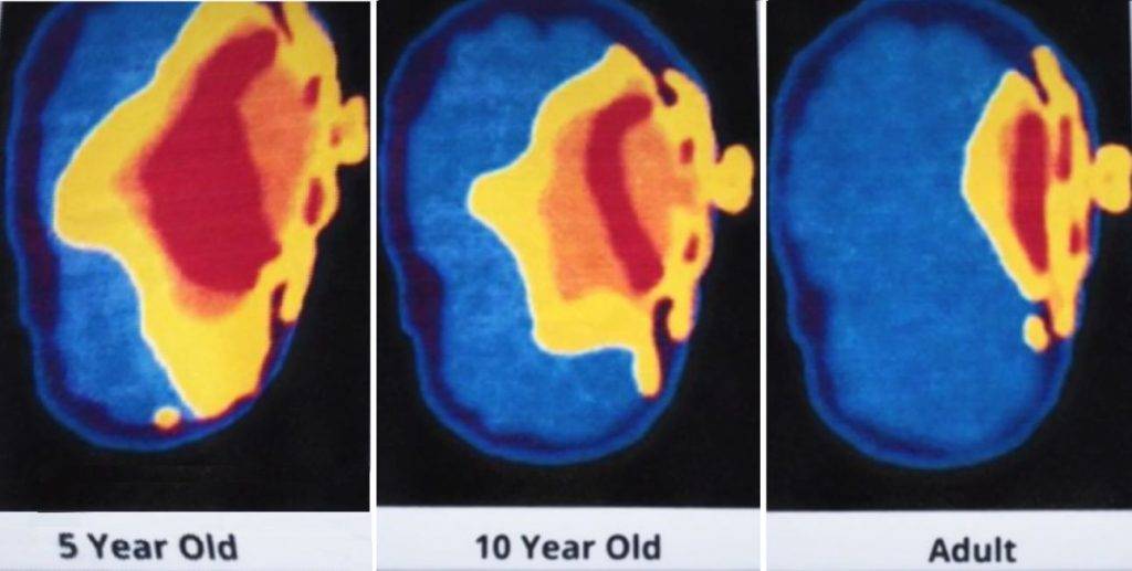 Le Iene Cellulare e cancro: ecco i rischi e come prevenirli