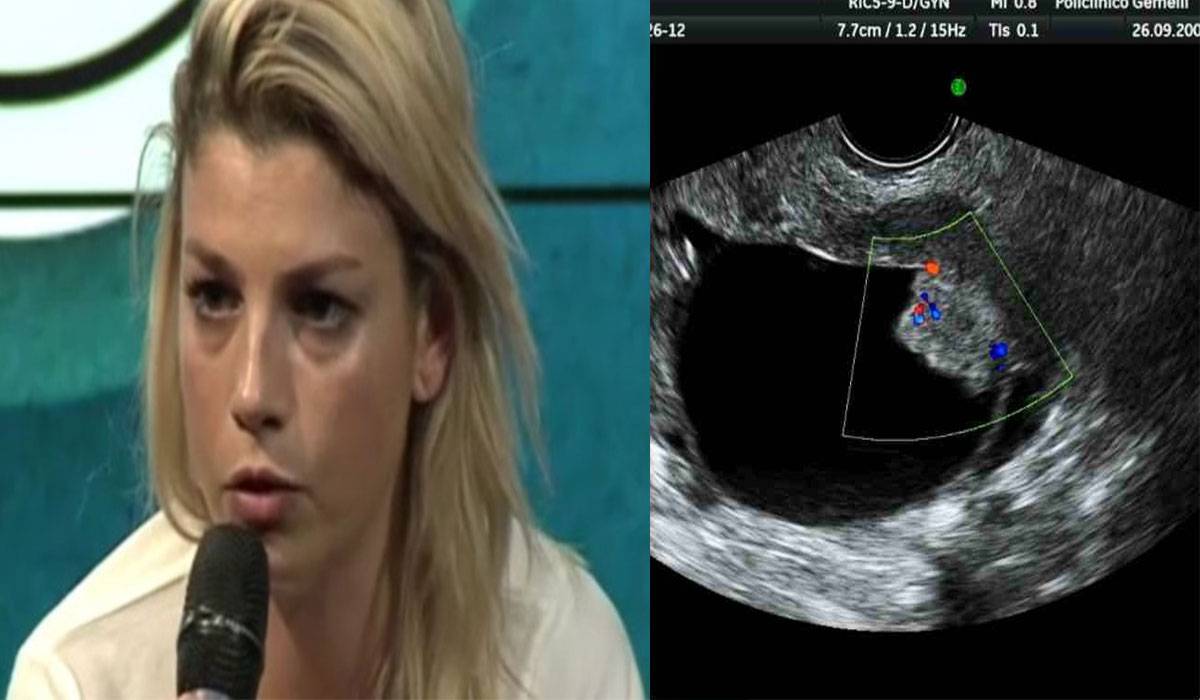 Emma Marrone il tumore è tornato