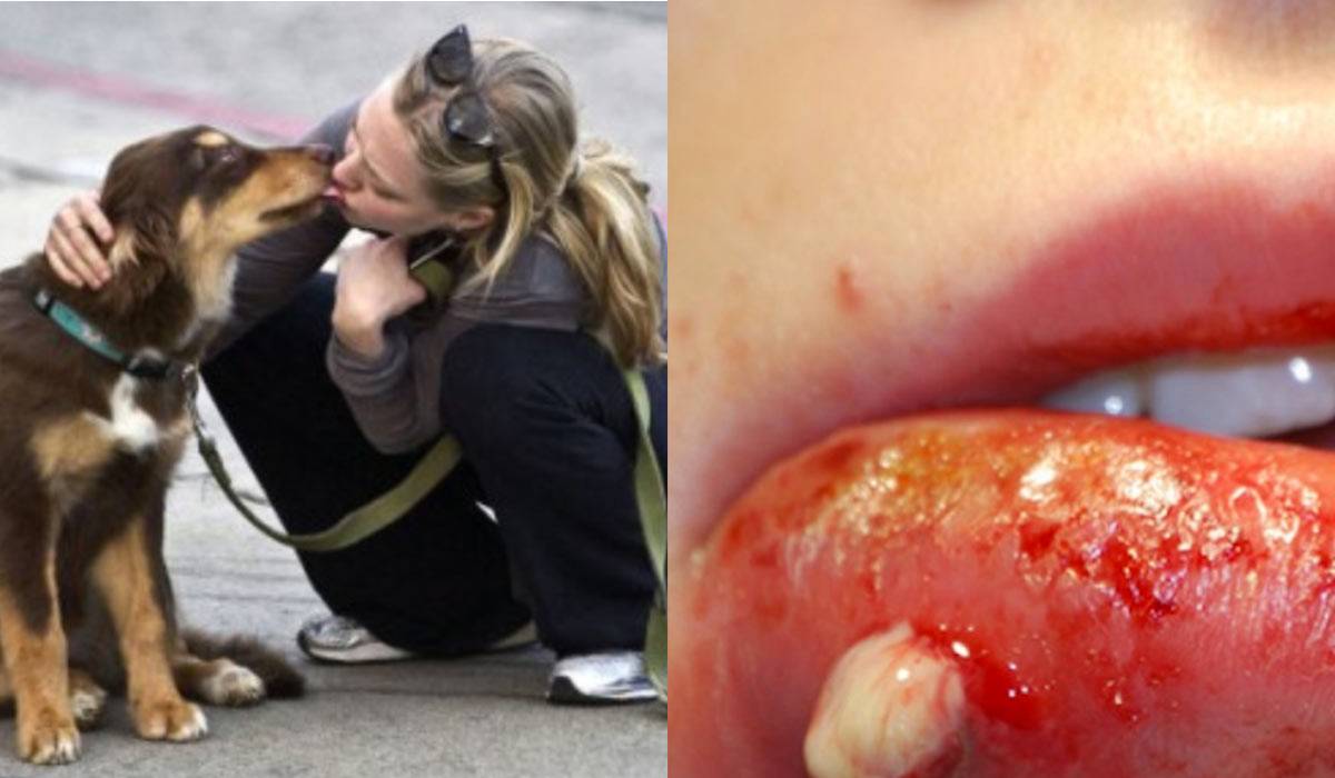 leccato dal cane muore