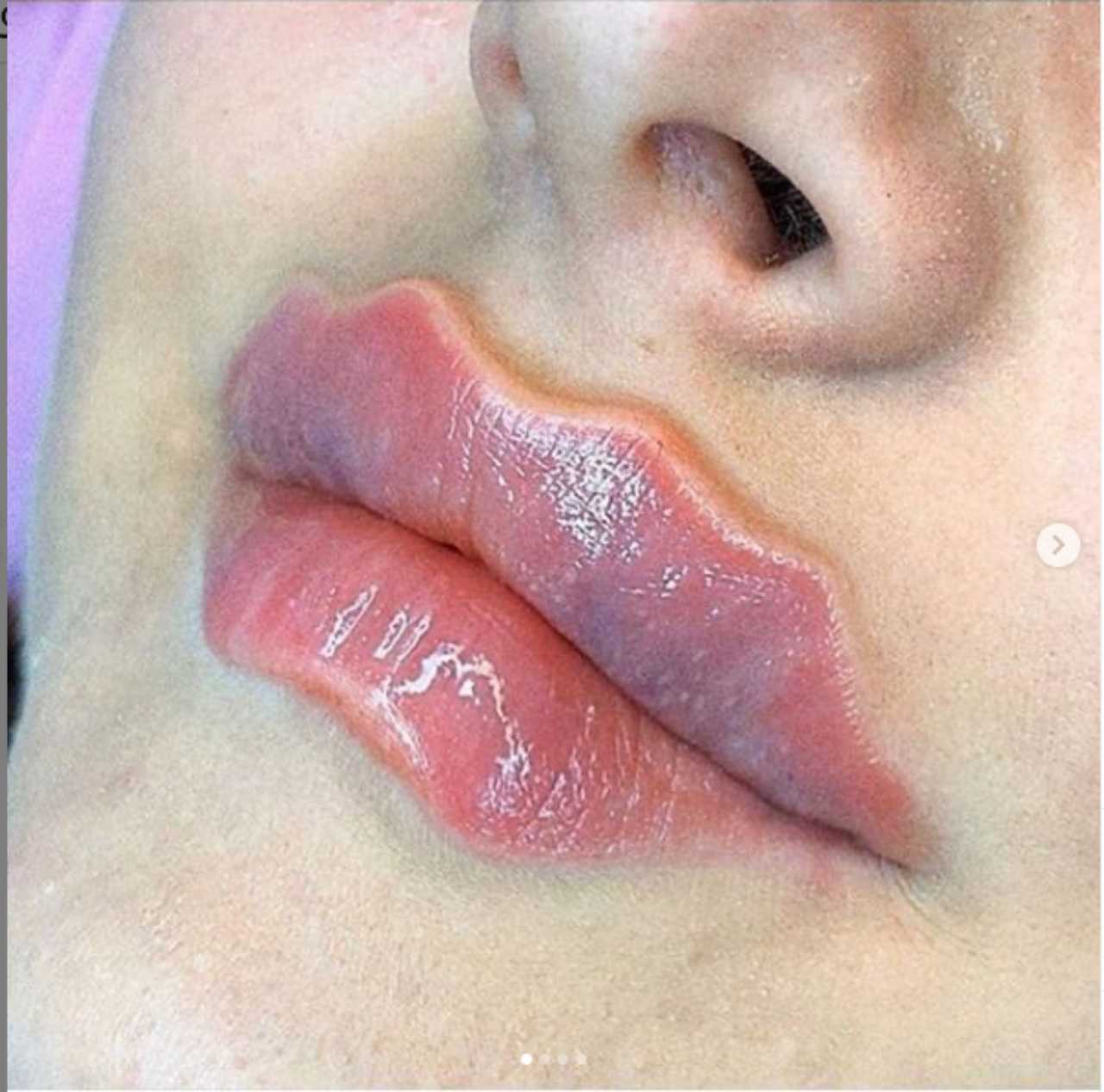 "labbra del diavolo"