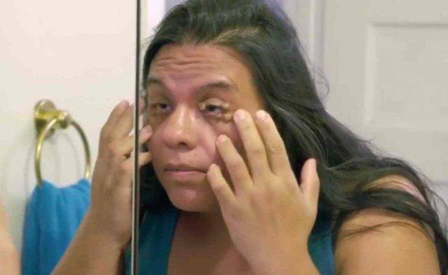 Hilda, Dr Pimple Popper (fonte Youtube)