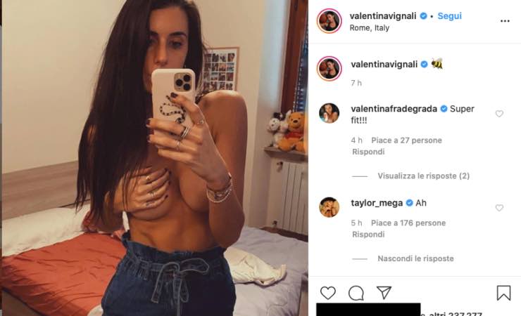 Valentina Vignali, via l'intimo nel selfie: "hai 2 punture sul petto"