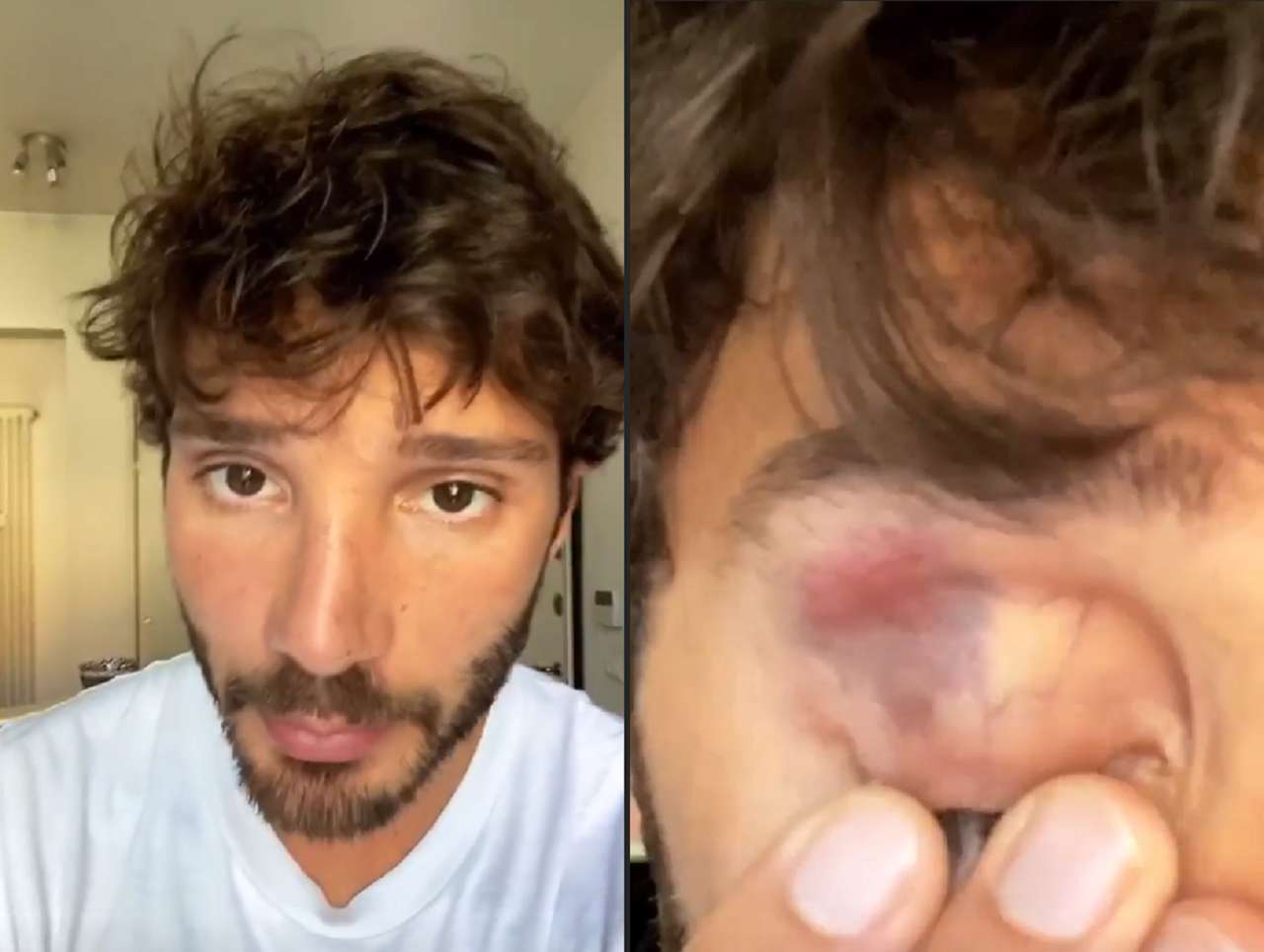 Stefano de martino occhio nero