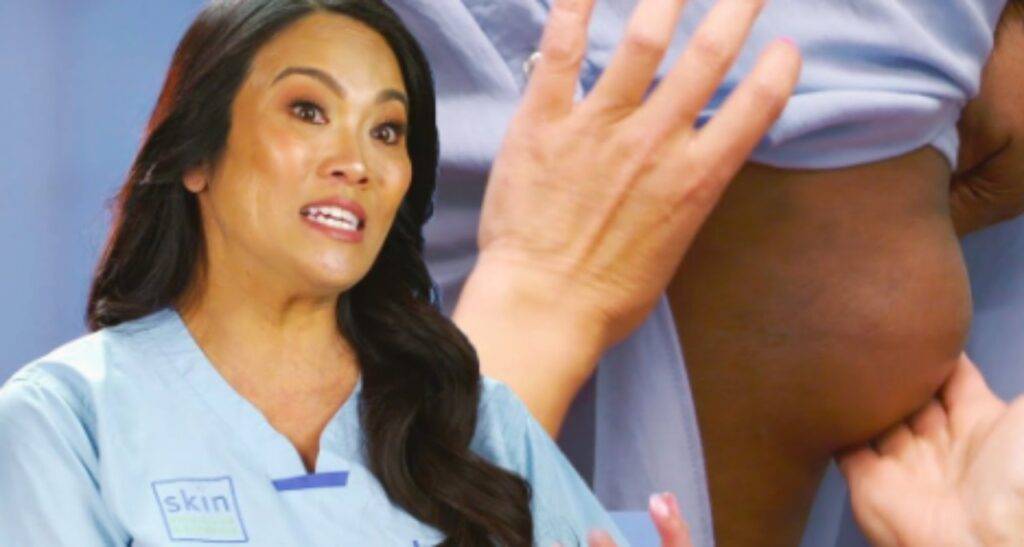 Dr Pimple Popper La Dottoressa Schiacciabrufoli Caso Curioso