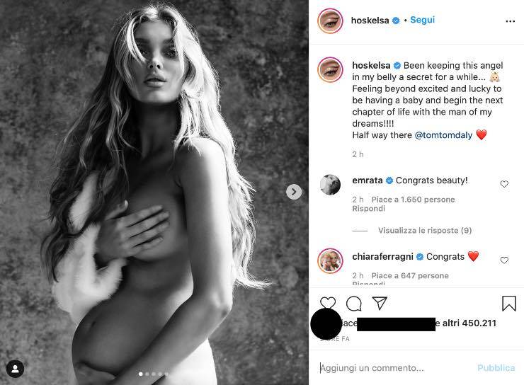 Elsa Hosk, senza veli stupisce i fan con un annuncio incredibile