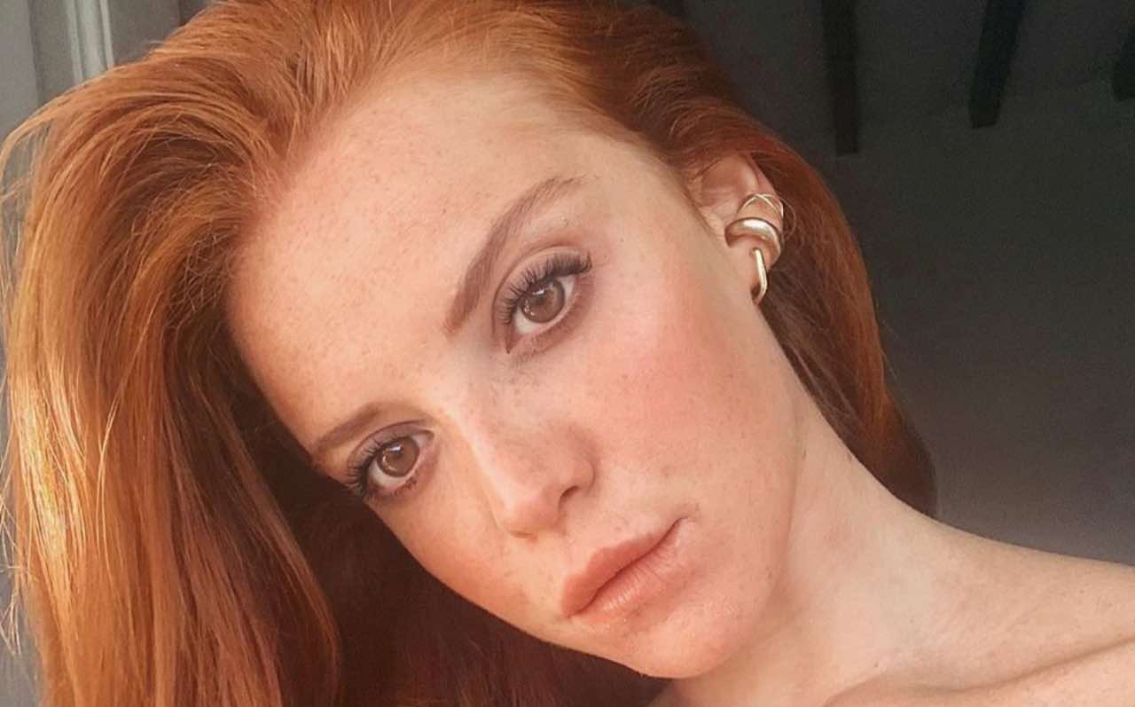 Ludovica Bizzaglia non si nasconde più e mostra i segni della malattia