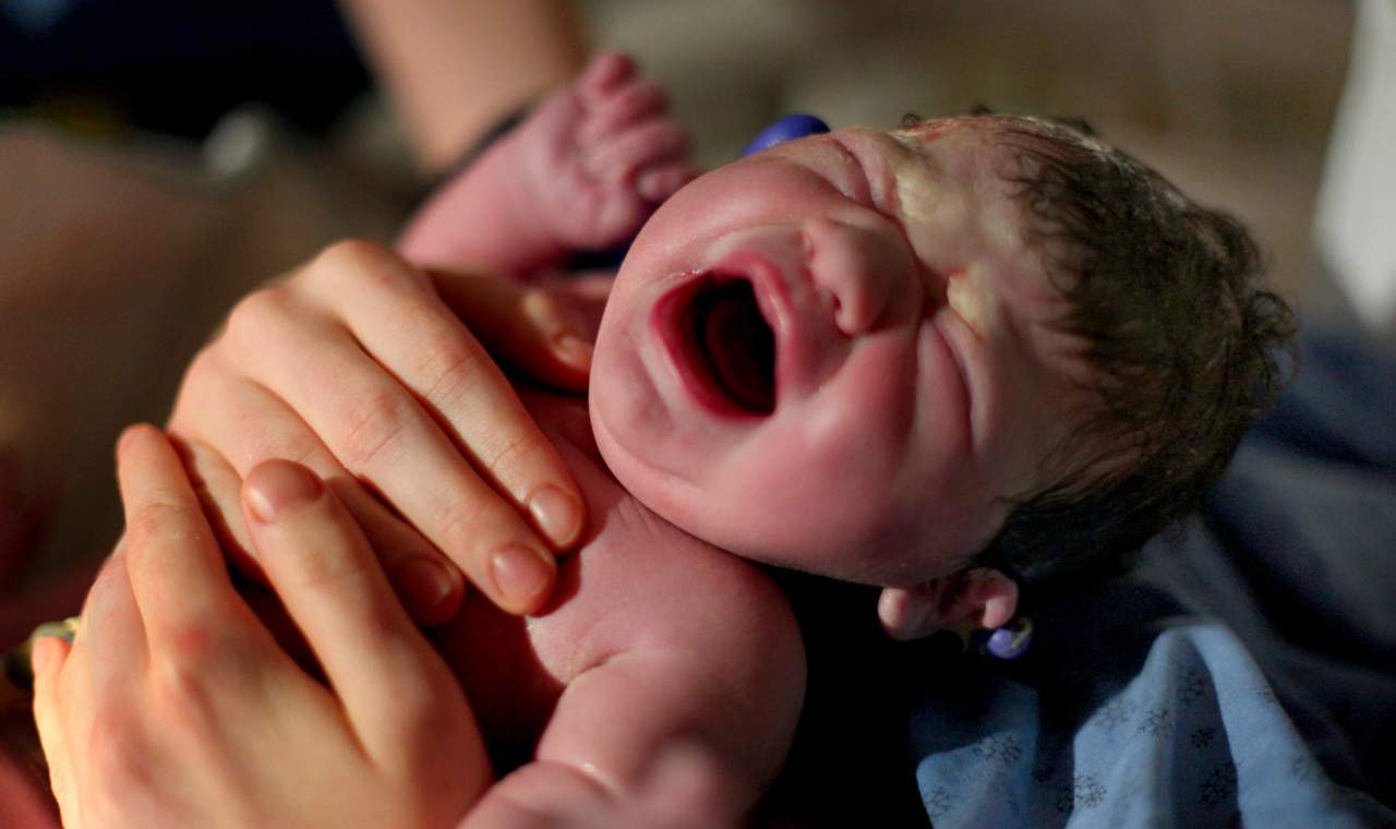 Новорожденный стресс. Гематома у новорожденных. Родовой травмы новорожденных детей.