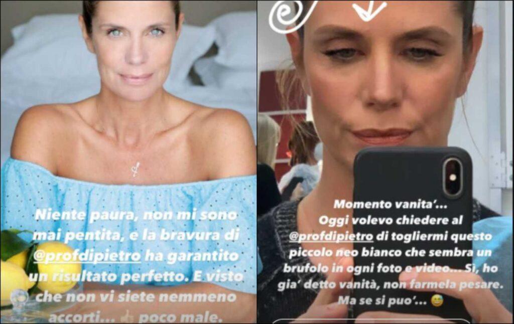 Filippa Lagerback mostra in un video come è cambiato il suo volto nel corso degli anni, i fan sono rimasti senza parole notando che il suo tratto distintivo è sparito.