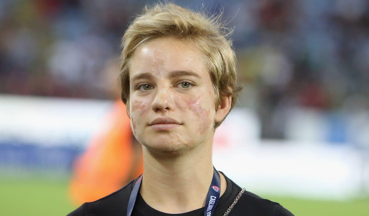 Bebe Vio, l'espressione dice tutto: "Padre nostro aiutami tu"