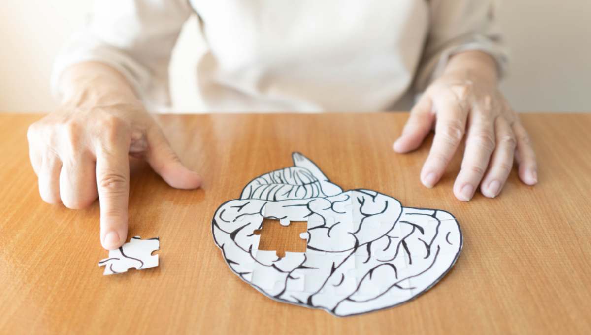 Alzheimer, cervello (AdobeStock)