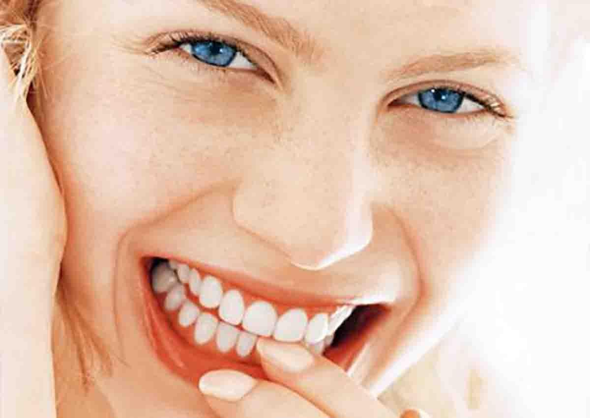 Denti bianchi, come curarli (facebook)
