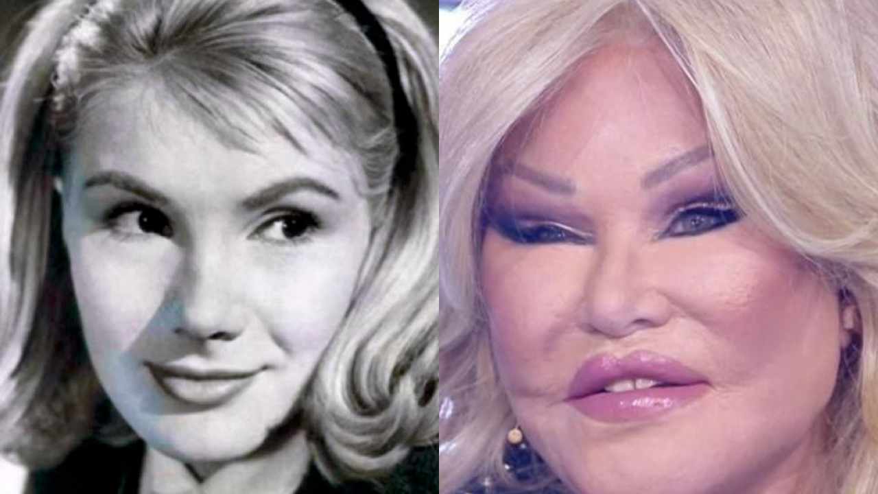 Jocelyn Wildenstein, chirurgia