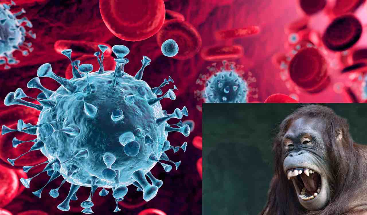 Vaiolo delle scimmie